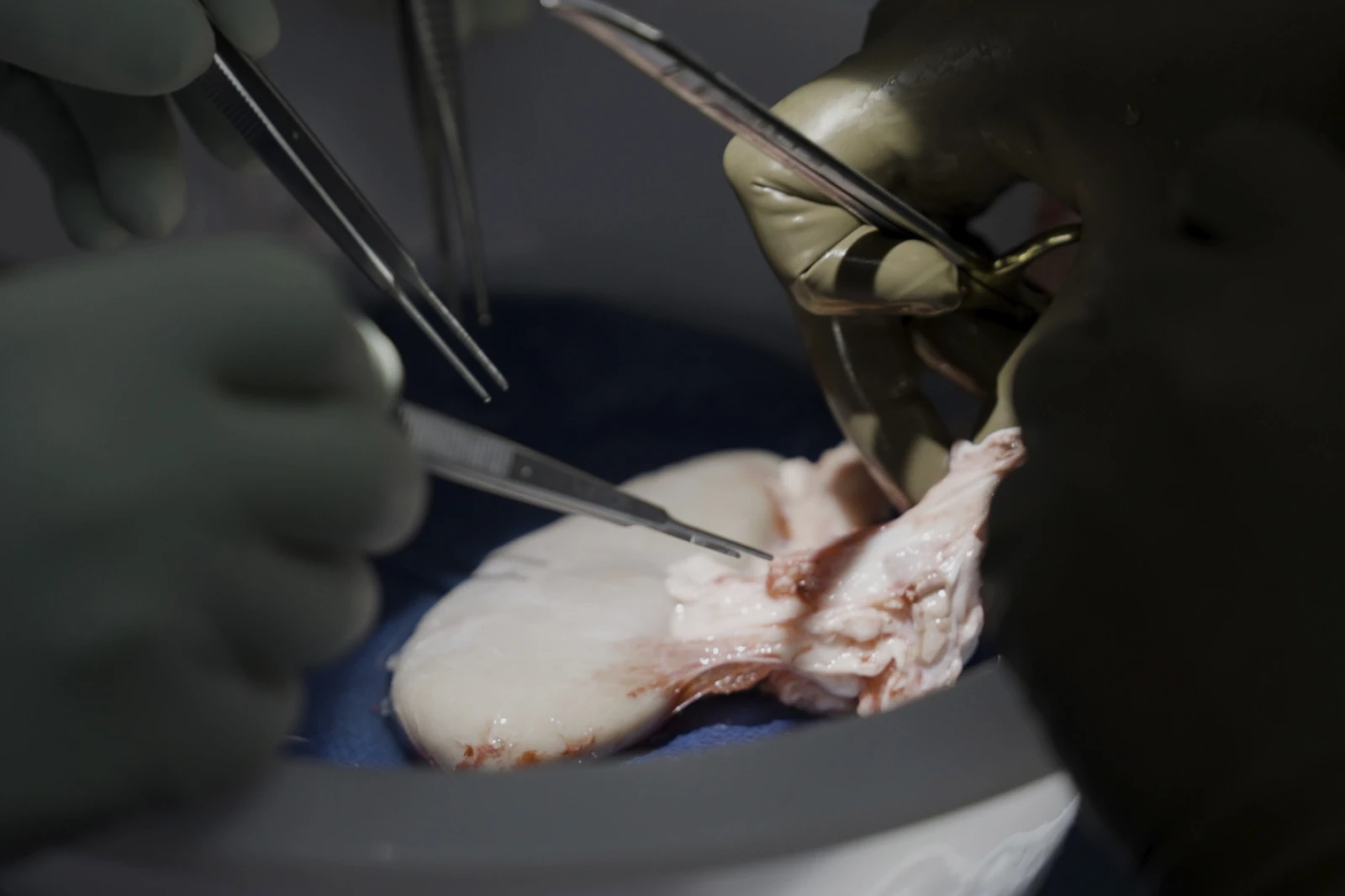Pig kidney works in a donated body for over a month, a step toward animal-human transplants